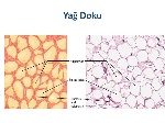 YAĞ DOKU
