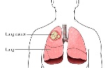 n1497