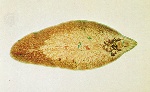 Liver+fluke
