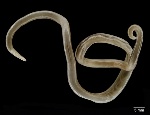 ascaris_lumbricoides_dubs