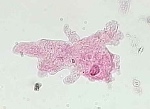 Amoeba